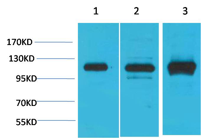 CaVα2δ2 Rabbit pAb