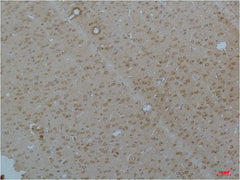 Cav pan α1 Rabbit pAb