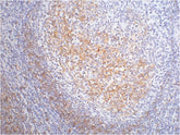 CD23 Mouse mAb