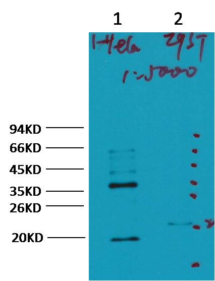 CA IX/Carbonic Anhydrase IX Mouse mAb