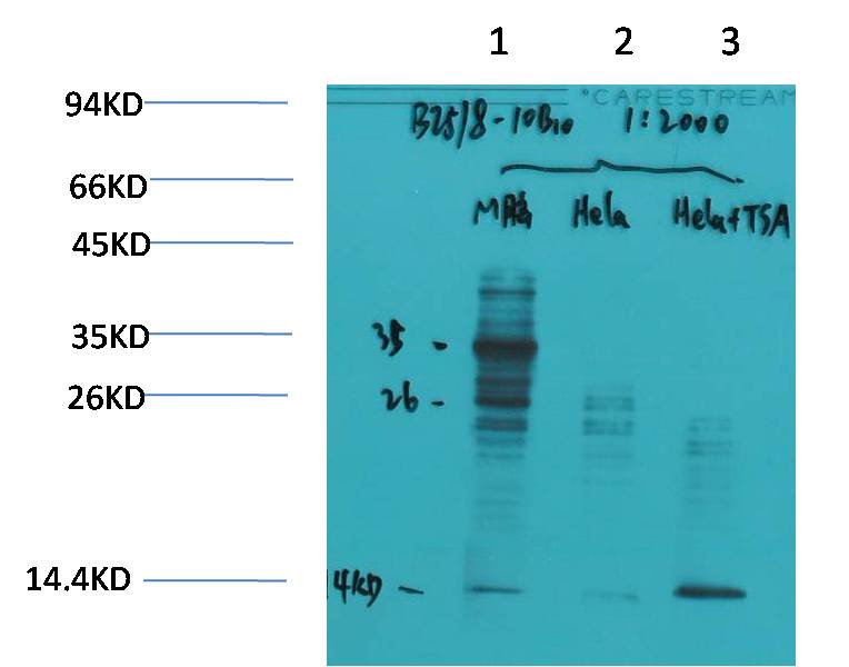 Acetyl Lysine Mouse mAb