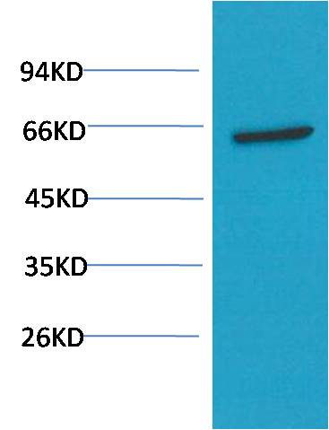 AKT (1H2) Mouse mAb