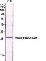 Bcl-2 (phospho Ser70) rabbit pAb