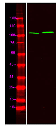 Catenin δ-1 (phospho-Tyr904) rabbit pAb
