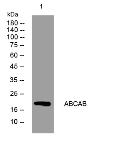 ABCAB rabbit pAb