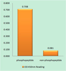 Catenin-β (phospho Ser33) rabbit pAb
