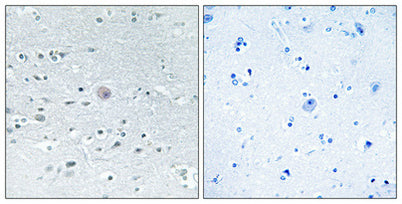 Arylsulfatase F rabbit pAb