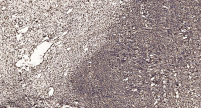 Calgizzarin rabbit pAb