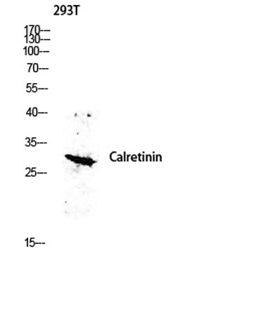 Calretinin rabbit pAb