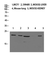 Calcitonin rabbit pAb