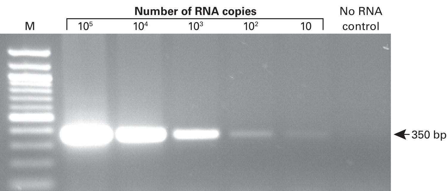 SMARTScribe Reverse Transcriptase - mRNA and cDNA synthesis - Takara Bio