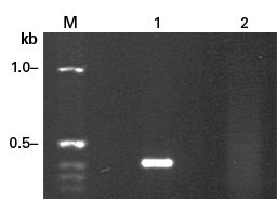 cDNA library construction kits - mRNA and cDNA synthesis - Takara Bio