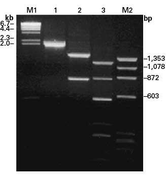 Tissue-specific human cDNA: reproductive system - mRNA and cDNA synthesis - Takara Bio