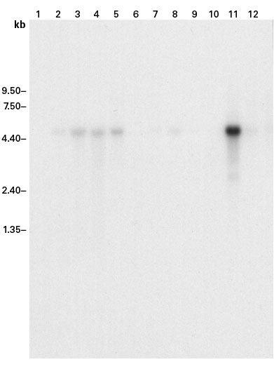 ExpressHyb Hybridization Solution - mRNA and cDNA synthesis - Takara Bio