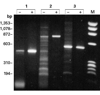 TaqStart Antibody: turn any Taq into a hot-start Taq - PCR - Takara Bio