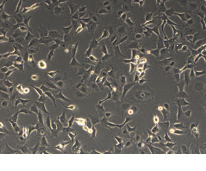 293 cells for adenoviral packaging - Gene function - Takara Bio