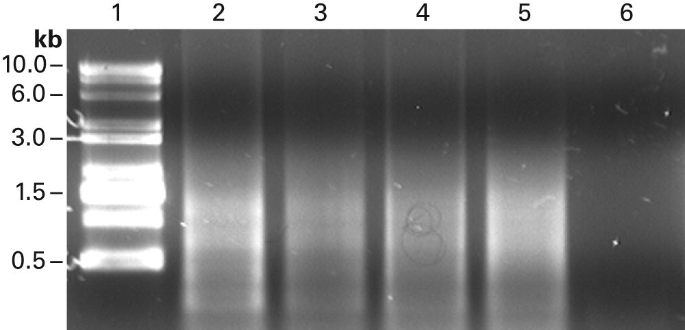 Ultrapure SMART MMLV Reverse Transcriptase for RT-PCR - mRNA and cDNA synthesis - Takara Bio