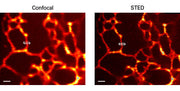 E2-Crimson fluorescent protein - Gene function - Takara Bio