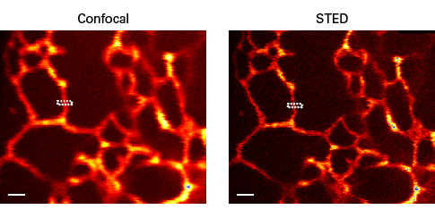 E2-Crimson fluorescent protein - Gene function - Takara Bio
