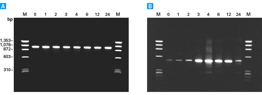 Reverse transcription and cDNA synthesis kit - mRNA and cDNA synthesis - Takara Bio