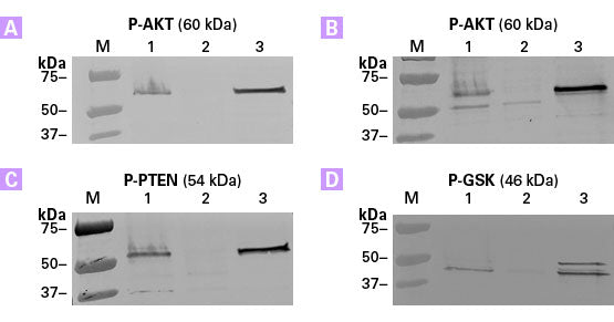 TALON PMAC Magnetic Phospho Enrichment Kit - Protein research - Takara Bio