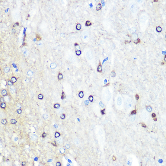 Tau Rabbit pAb