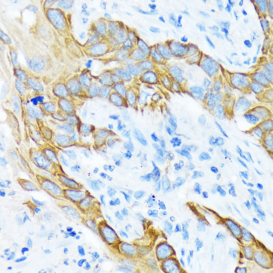 Cytokeratin 4 (KRT4) Rabbit mAb
