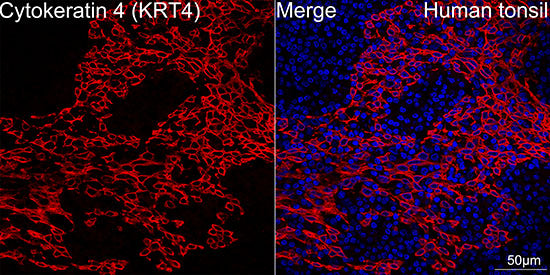 Cytokeratin 4 (KRT4) Rabbit mAb