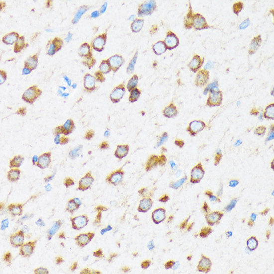 KAT9/Elp3 Rabbit mAb