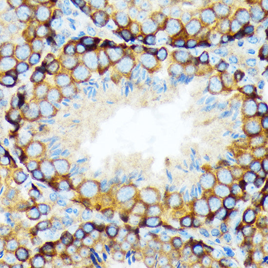KAT9/Elp3 Rabbit mAb