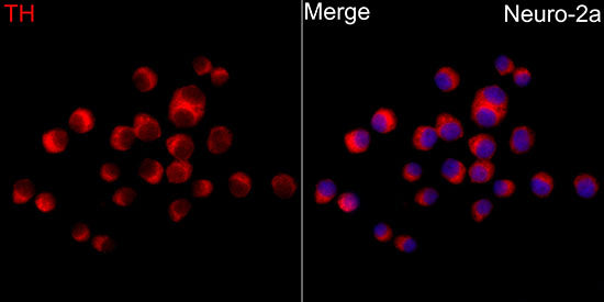 Tyrosine Hydroxylase Rabbit pAb