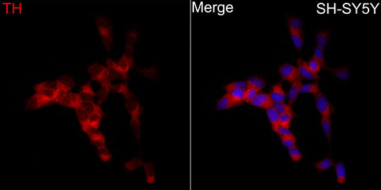 Tyrosine Hydroxylase Rabbit pAb