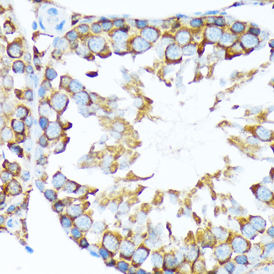 STIP1 Rabbit mAb