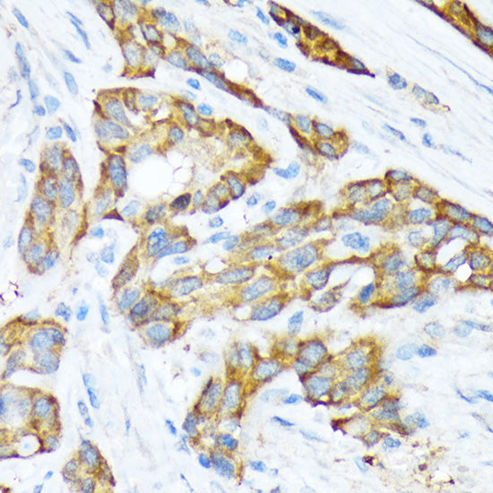 STIP1 Rabbit mAb