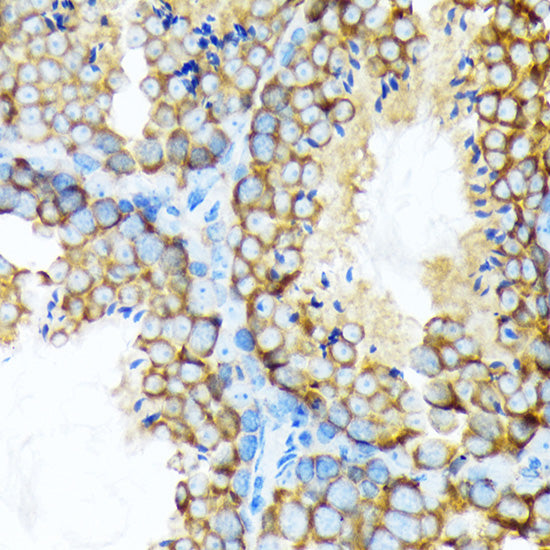 STIP1 Rabbit mAb