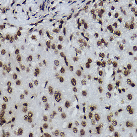 Formyl-Histone H2B-K120 Rabbit mAb