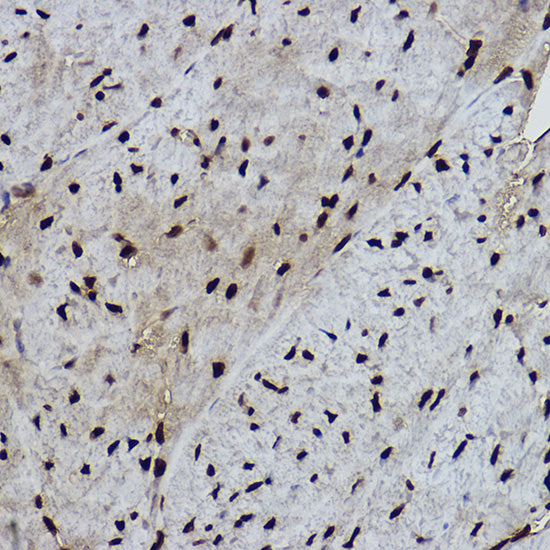 Formyl-Histone H2B-K120 Rabbit mAb