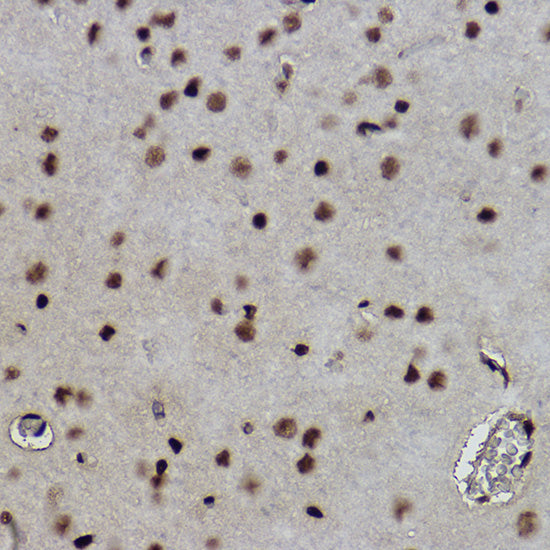 Formyl-Histone H2B-K120 Rabbit mAb