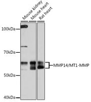 MMP14/MT1-MMP Rabbit mAb