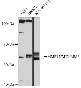 MMP14/MT1-MMP Rabbit mAb