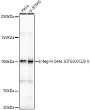 Integrin beta 3 (ITGB3/CD61) Rabbit pAb