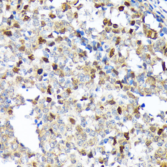 KIFC1 Rabbit mAb