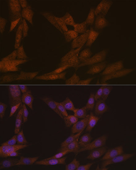 KIFC1 Rabbit mAb