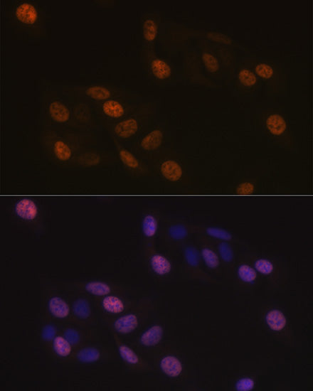 KIFC1 Rabbit mAb