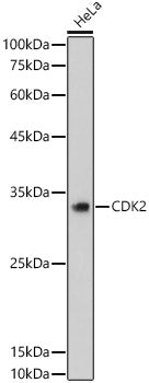 [KO Validated] CDK2 Rabbit mAb