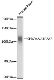 SERCA2/ATP2A2 Rabbit pAb