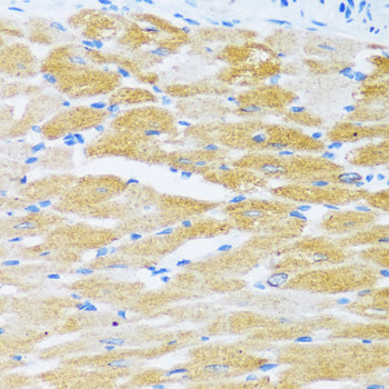 SERCA2/ATP2A2 Rabbit pAb