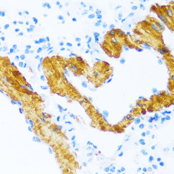 SERCA2/ATP2A2 Rabbit pAb