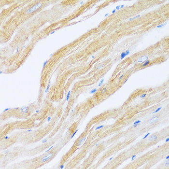SERCA2/ATP2A2 Rabbit pAb