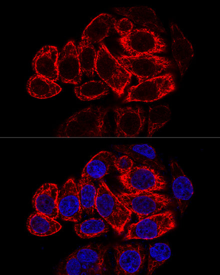 Cytokeratin 17 (KRT17) Rabbit pAb
